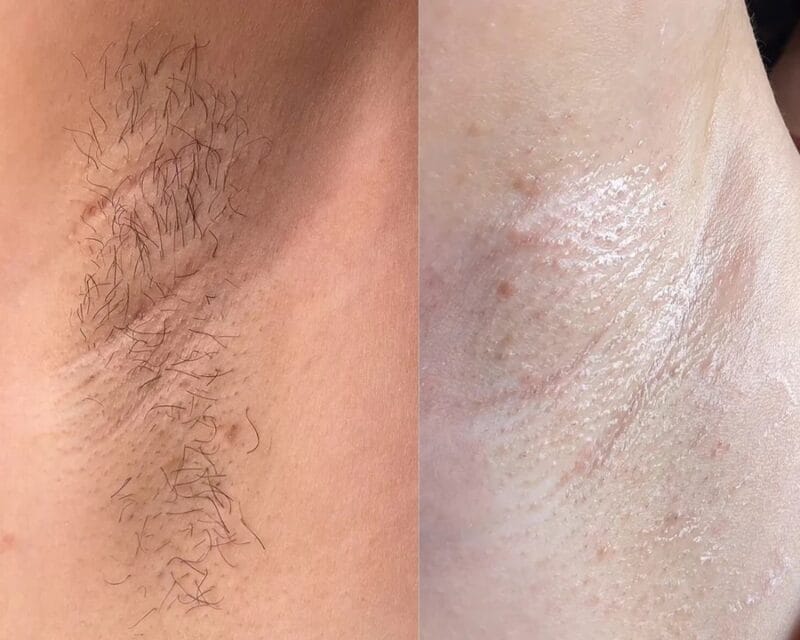 ArmpitJellyWax